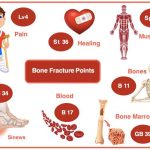 0016_Fracture-Remedies